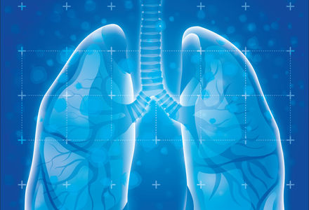 European first for new immunotherapy lung cancer trial in Dundee